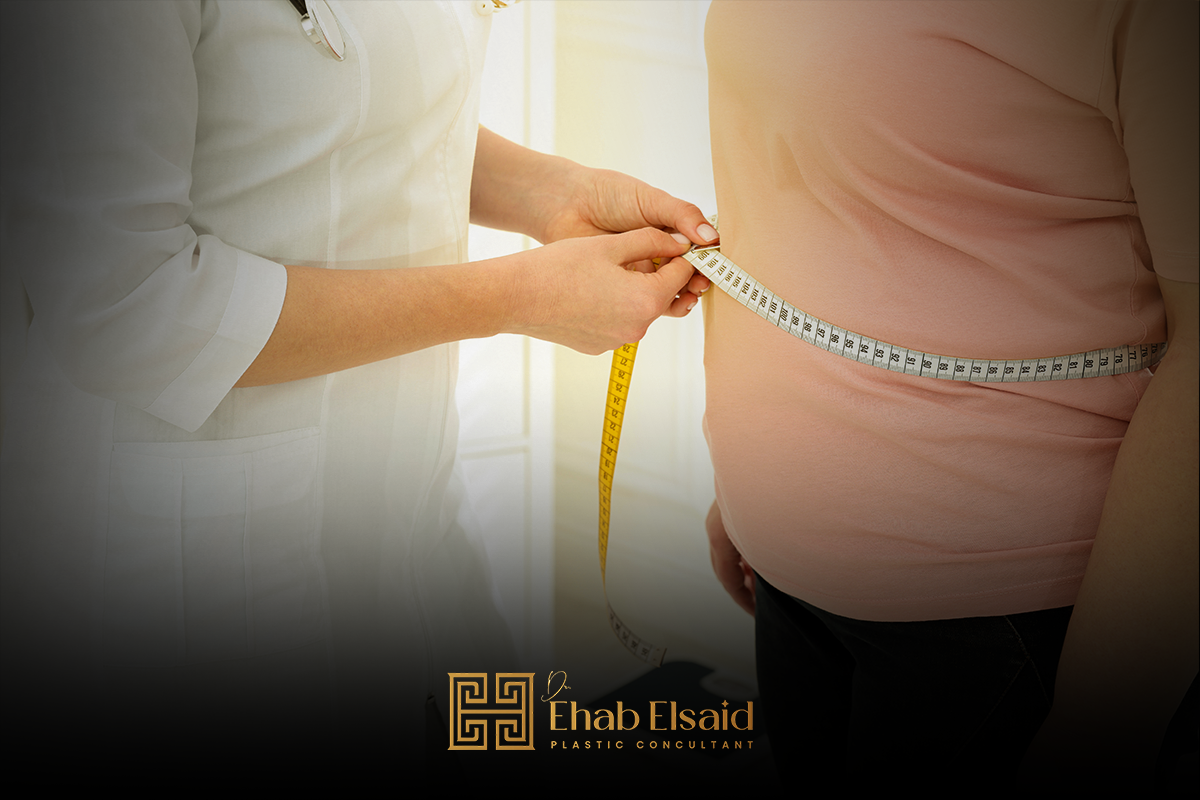 أفضل دكتور شفط دهون في المنصورة (3)